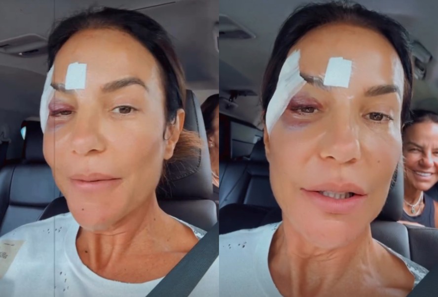 Ivete Sangalo tranquiliza fãs após ser hospitalizada às pressas