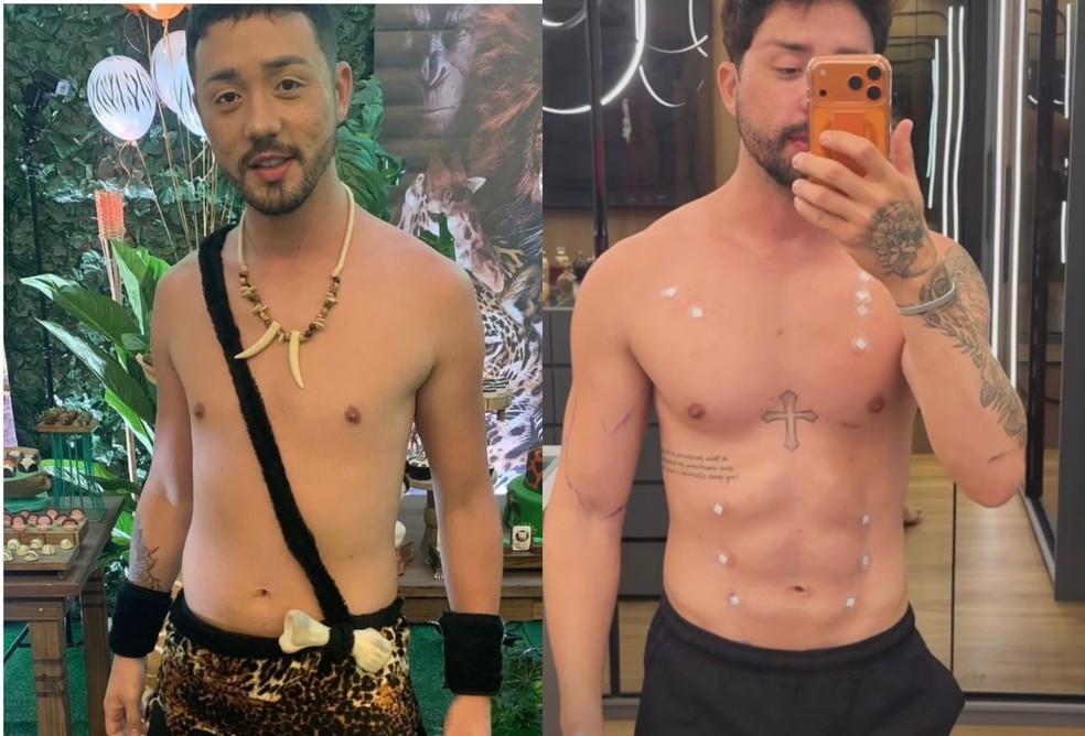 Rico Melquiades mostra antes e depois de procedimento estético no abdômen — Foto: Reprodução/Instagram