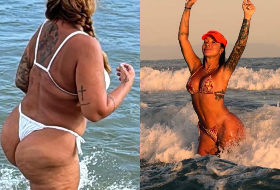 Vivi Fernandez antes e depois de cirurgias plásticas — Foto: Divulgação